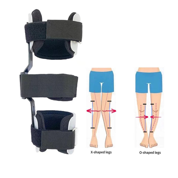 1Pair Kids O/X Leg Posture Corrector Brace Knees Valgus Straighten Bow-legged Correction Braces Adjustable