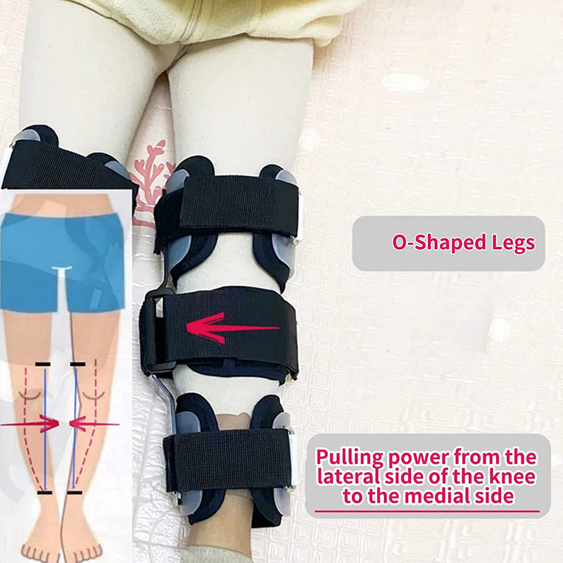 1Pair Kids O/X Leg Posture Corrector Brace Knees Valgus Straighten Bow-legged Correction Braces Adjustable