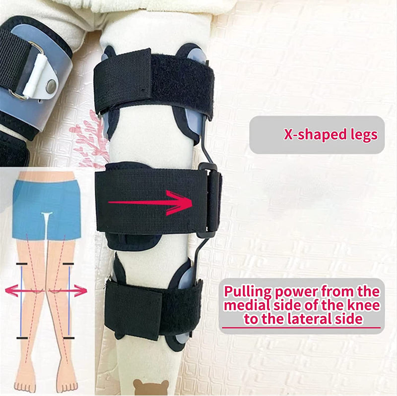 1Pair Kids O/X Leg Posture Corrector Brace Knees Valgus Straighten Bow-legged Correction Braces Adjustable